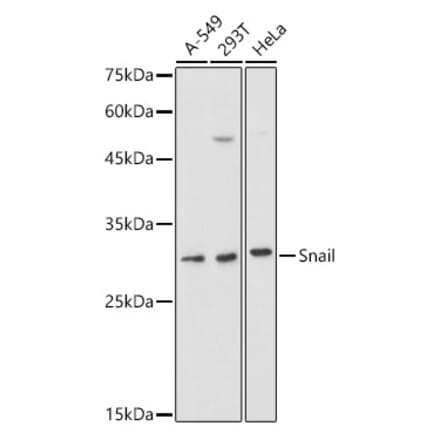 Western Blot - Anti-SNAIL Antibody (A14634) - Antibodies.com