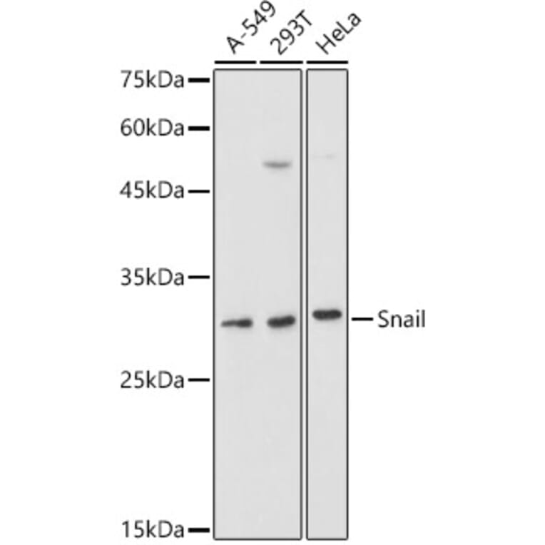 Western Blot - Anti-SNAIL Antibody (A14634) - Antibodies.com