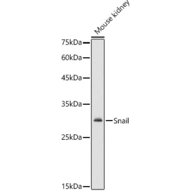 Western Blot - Anti-SNAIL Antibody (A14634) - Antibodies.com