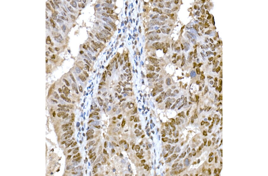 Immunohistochemistry - Anti-SNAIL Antibody (A14634) - Antibodies.com
