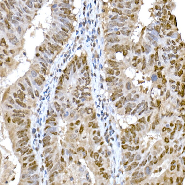 Immunohistochemistry - Anti-SNAIL Antibody (A14634) - Antibodies.com