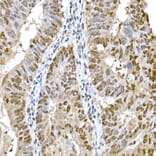 Immunohistochemistry - Anti-SNAIL Antibody (A14634) - Antibodies.com
