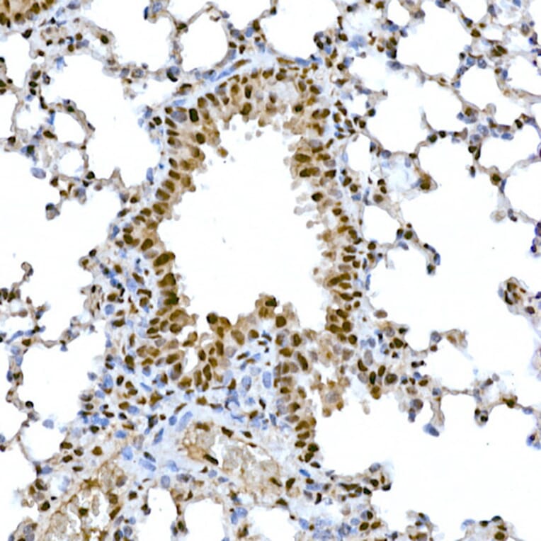 Immunohistochemistry - Anti-SNAIL Antibody (A14634) - Antibodies.com