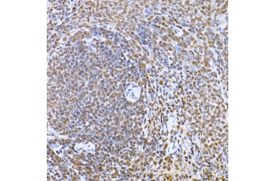 Immunohistochemistry - Anti-SNAIL Antibody (A14634) - Antibodies.com