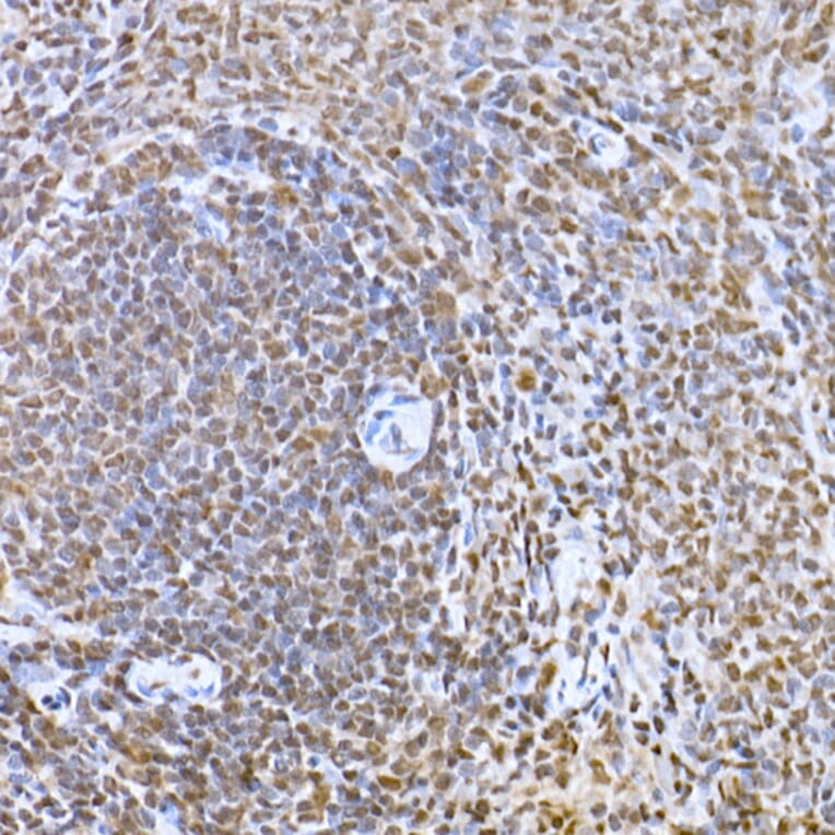 Immunohistochemistry - Anti-SNAIL Antibody (A14634) - Antibodies.com