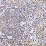 Immunohistochemistry - Anti-SNAIL Antibody (A14634) - Antibodies.com