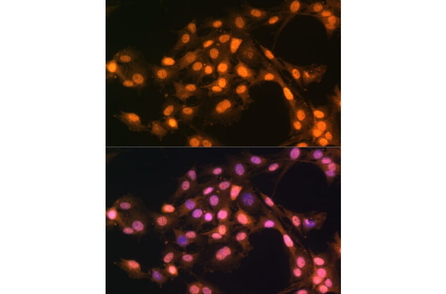 Immunofluorescence - Anti-SNAIL Antibody (A14634) - Antibodies.com