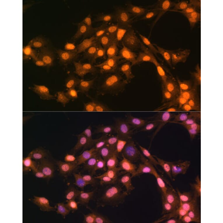 Immunofluorescence - Anti-SNAIL Antibody (A14634) - Antibodies.com