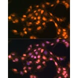 Immunofluorescence - Anti-SNAIL Antibody (A14634) - Antibodies.com