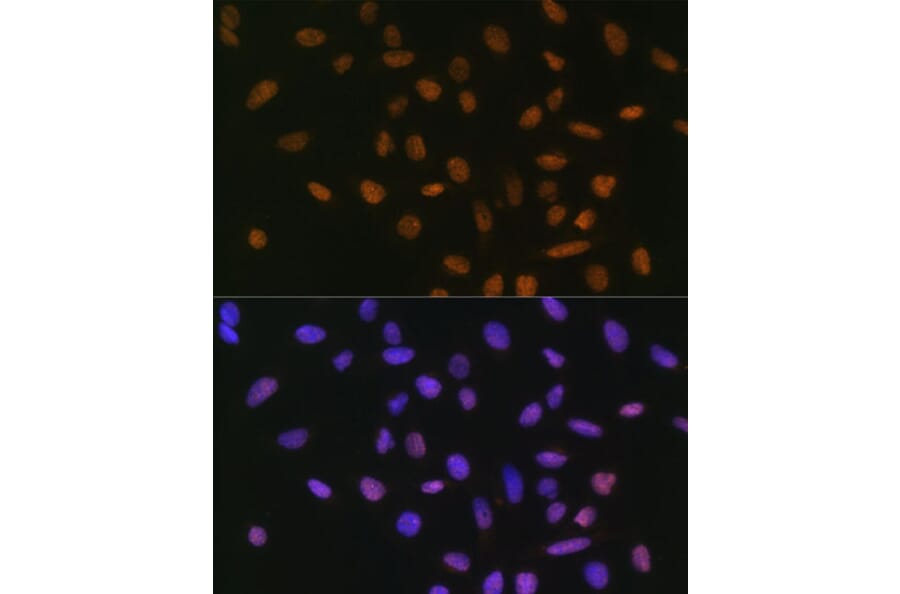 Immunofluorescence - Anti-SNAIL Antibody (A14634) - Antibodies.com
