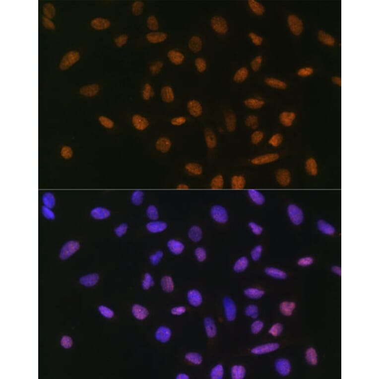 Immunofluorescence - Anti-SNAIL Antibody (A14634) - Antibodies.com