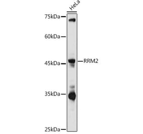 Western Blot - Anti-RRM2 Antibody (A14635) - Antibodies.com