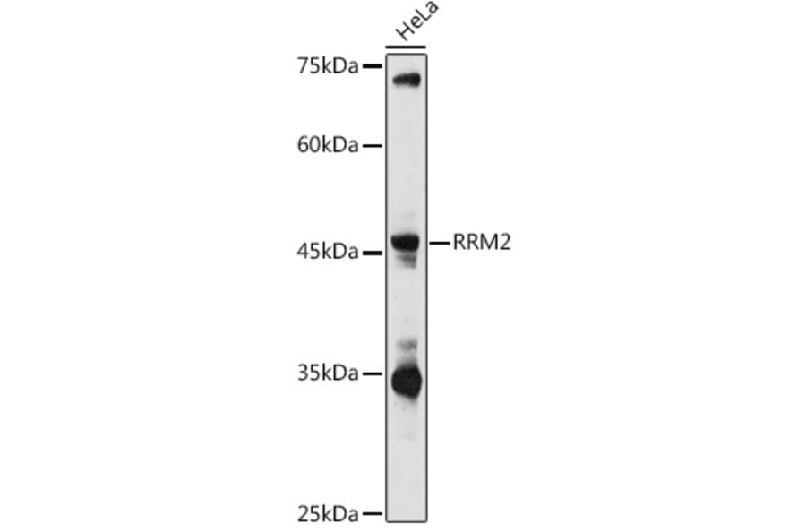 Western Blot - Anti-RRM2 Antibody (A14635) - Antibodies.com