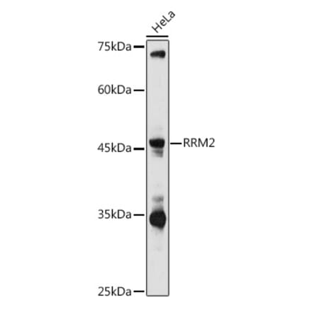 Western Blot - Anti-RRM2 Antibody (A14635) - Antibodies.com