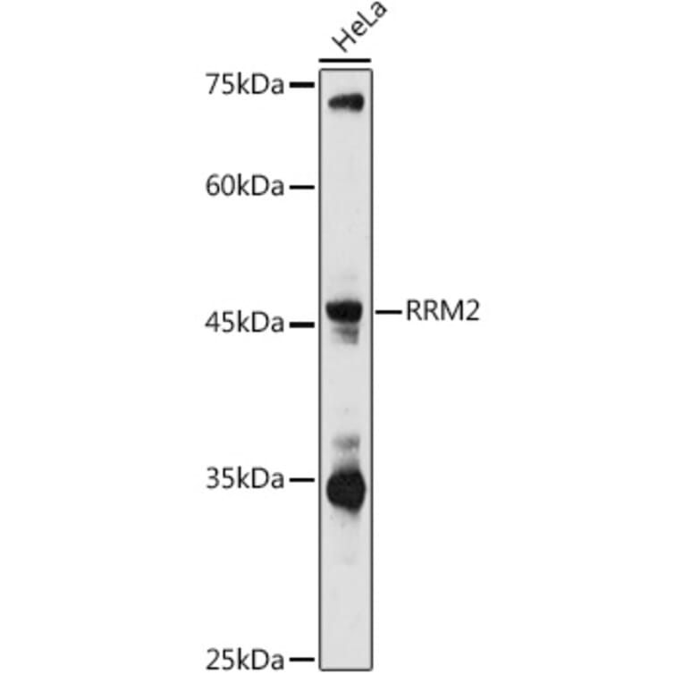 Western Blot - Anti-RRM2 Antibody (A14635) - Antibodies.com