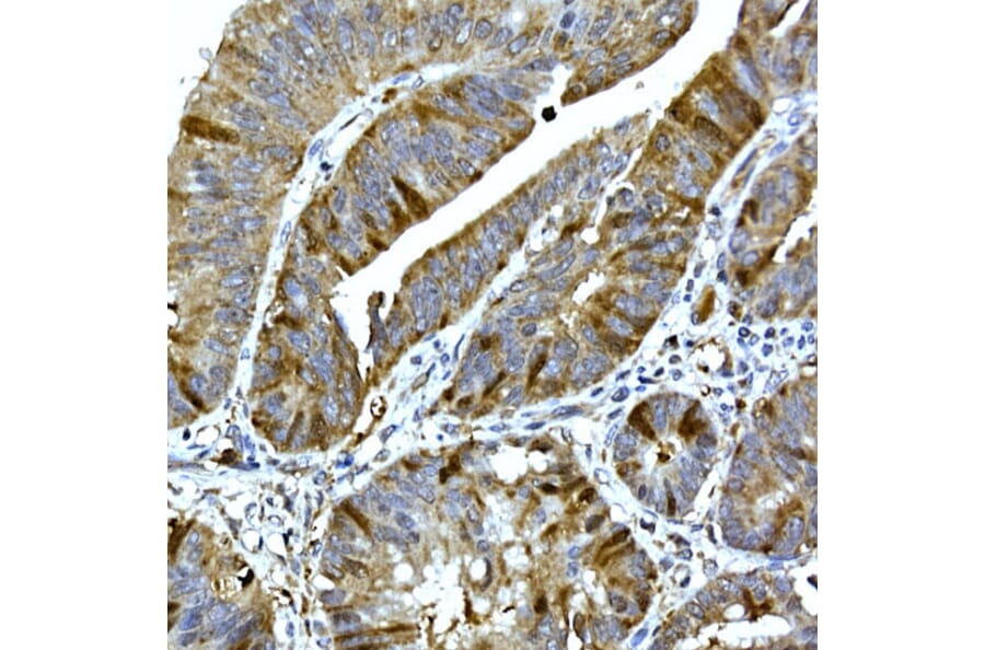 Immunohistochemistry - Anti-RRM2 Antibody (A14635) - Antibodies.com