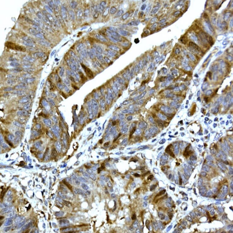 Immunohistochemistry - Anti-RRM2 Antibody (A14635) - Antibodies.com
