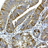 Immunohistochemistry - Anti-RRM2 Antibody (A14635) - Antibodies.com