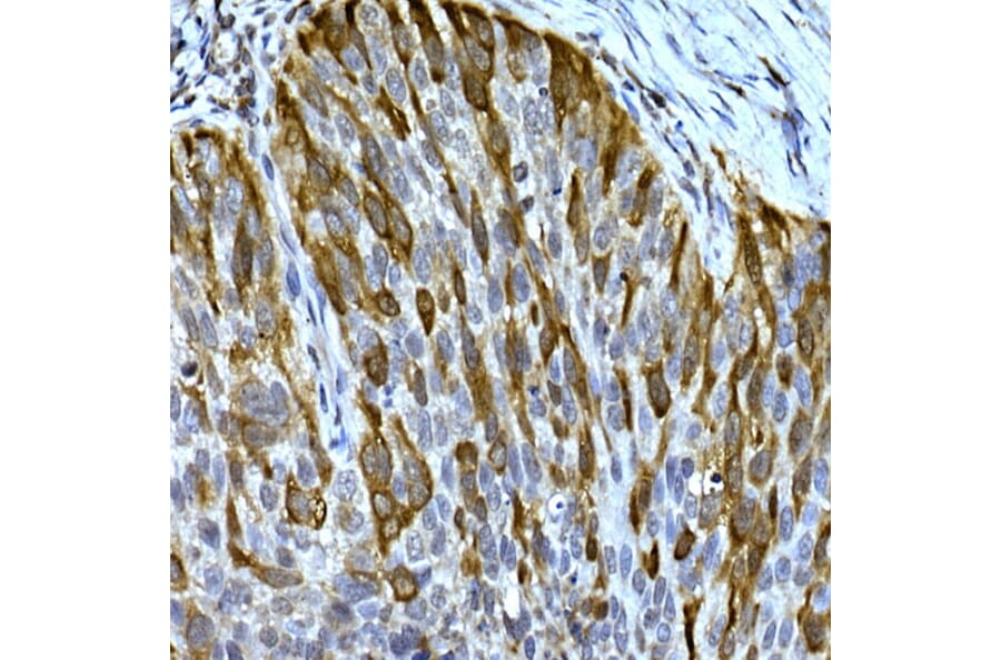 Immunohistochemistry - Anti-RRM2 Antibody (A14635) - Antibodies.com