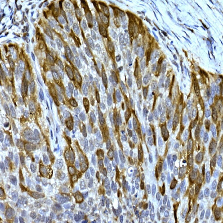 Immunohistochemistry - Anti-RRM2 Antibody (A14635) - Antibodies.com