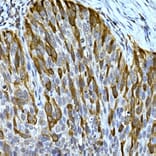 Immunohistochemistry - Anti-RRM2 Antibody (A14635) - Antibodies.com