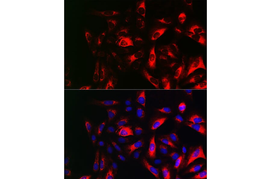 Immunofluorescence - Anti-RRM2 Antibody (A14635) - Antibodies.com