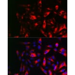 Immunofluorescence - Anti-RRM2 Antibody (A14635) - Antibodies.com