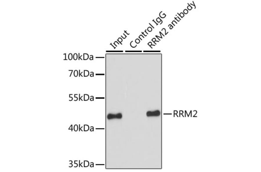 Western Blot - Anti-RRM2 Antibody (A14635) - Antibodies.com