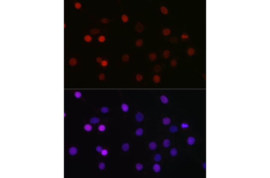 Immunofluorescence - Anti-KMT5A/SETD8/Pr-SET7 Antibody (A14636) - Antibodies.com
