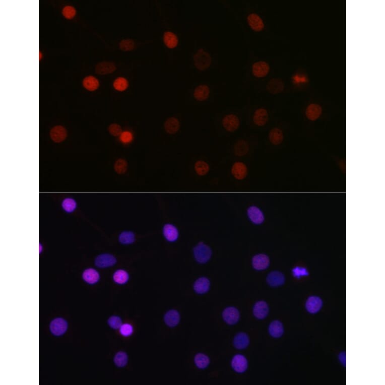Immunofluorescence - Anti-KMT5A/SETD8/Pr-SET7 Antibody (A14636) - Antibodies.com