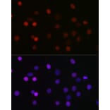 Immunofluorescence - Anti-KMT5A/SETD8/Pr-SET7 Antibody (A14636) - Antibodies.com