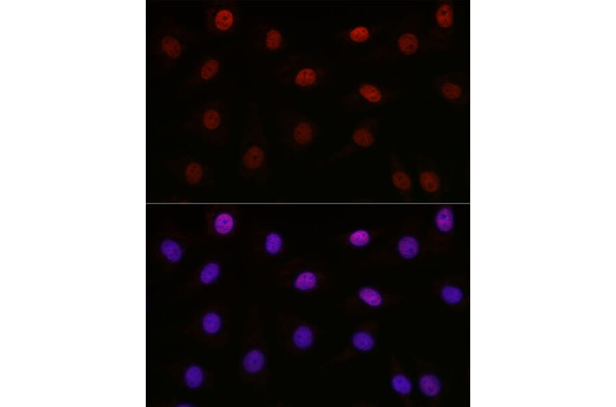 Immunofluorescence - Anti-KMT5A/SETD8/Pr-SET7 Antibody (A14636) - Antibodies.com