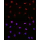 Immunofluorescence - Anti-KMT5A/SETD8/Pr-SET7 Antibody (A14636) - Antibodies.com