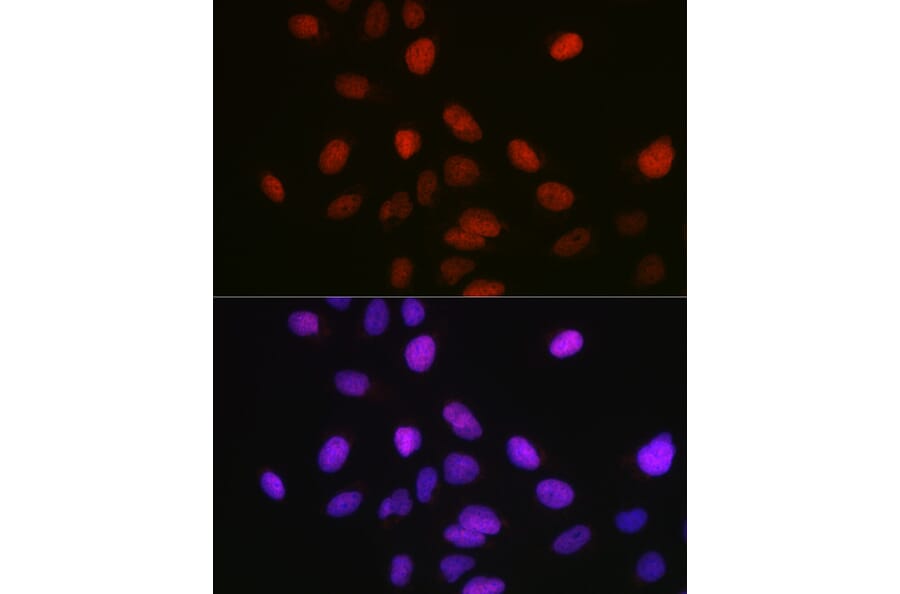 Immunofluorescence - Anti-KMT5A/SETD8/Pr-SET7 Antibody (A14636) - Antibodies.com