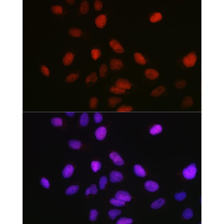 Immunofluorescence - Anti-KMT5A/SETD8/Pr-SET7 Antibody (A14636) - Antibodies.com