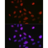 Immunofluorescence - Anti-KMT5A/SETD8/Pr-SET7 Antibody (A14636) - Antibodies.com