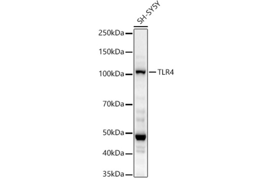 Western Blot - Anti-TLR4 Antibody (A14637) - Antibodies.com