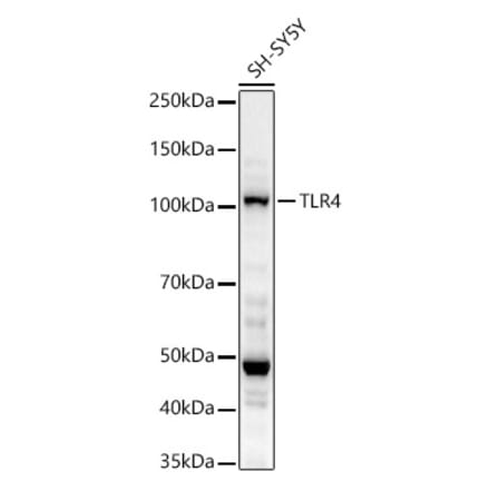 Western Blot - Anti-TLR4 Antibody (A14637) - Antibodies.com