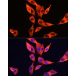 Immunofluorescence - Anti-TLR4 Antibody (A14637) - Antibodies.com