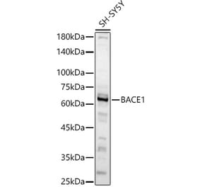 Western Blot - Anti-BACE1 Antibody (A14638) - Antibodies.com