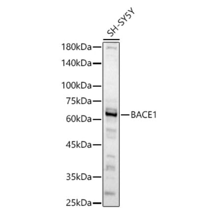 Western Blot - Anti-BACE1 Antibody (A14638) - Antibodies.com