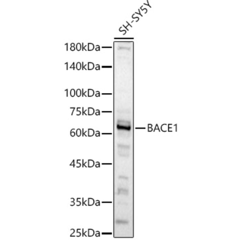 Western Blot - Anti-BACE1 Antibody (A14638) - Antibodies.com