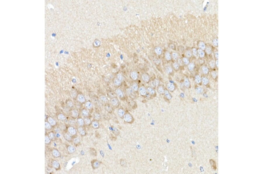 Immunohistochemistry - Anti-BACE1 Antibody (A14638) - Antibodies.com