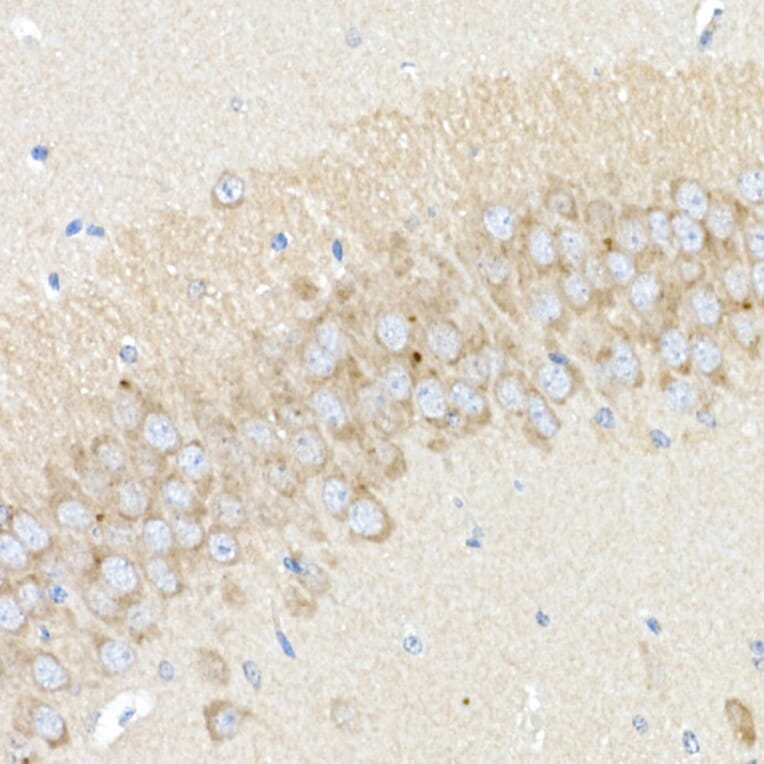 Immunohistochemistry - Anti-BACE1 Antibody (A14638) - Antibodies.com