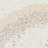 Immunohistochemistry - Anti-BACE1 Antibody (A14638) - Antibodies.com