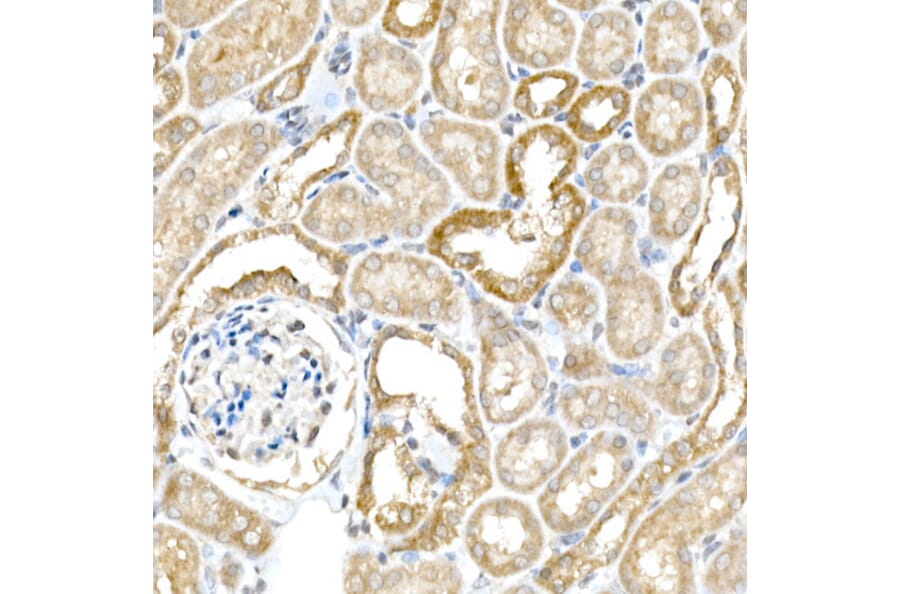 Immunohistochemistry - Anti-BACE1 Antibody (A14638) - Antibodies.com