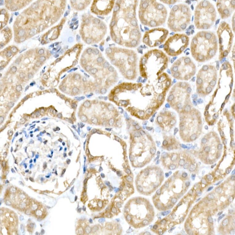 Immunohistochemistry - Anti-BACE1 Antibody (A14638) - Antibodies.com