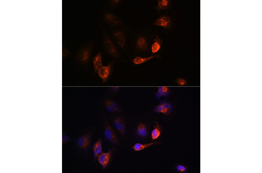 Immunofluorescence - Anti-BACE1 Antibody (A14638) - Antibodies.com
