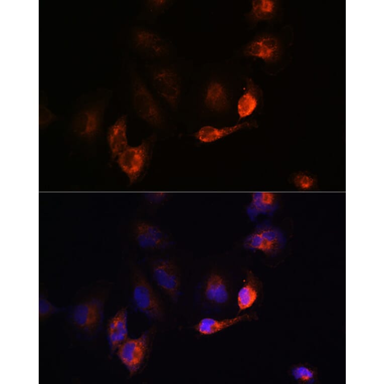 Immunofluorescence - Anti-BACE1 Antibody (A14638) - Antibodies.com