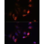 Immunofluorescence - Anti-BACE1 Antibody (A14638) - Antibodies.com